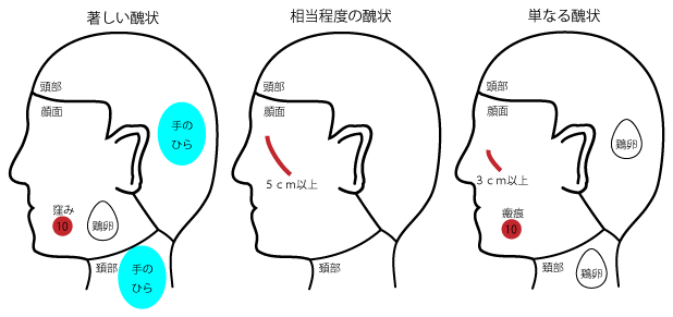 著しい醜状